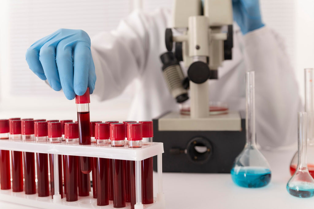 Follicle Stimulating Hormone (FSH) and Its Role in Male Fertility